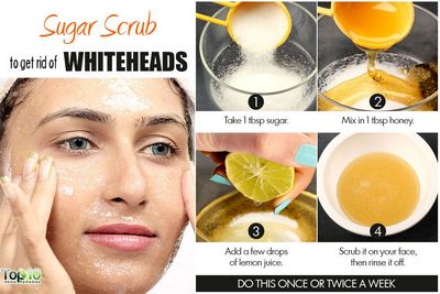 Get Rid of Whiteheads on Your Face